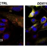 La proteina che pulisce le cellule apre nuove speranze nelle malattie neurodegenerative