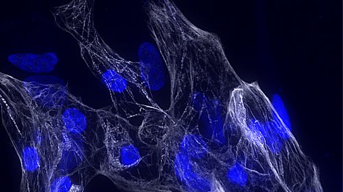 Scoperto un nuovo gene cruciale per la salute del cuore