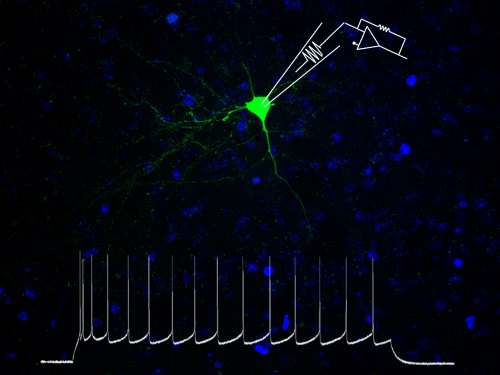 Depressione, scoperto il meccanismo cellulare che riduce l’attività dei neuroni
