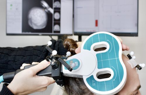 Quando i muscoli raccontano ciò che immaginiamo